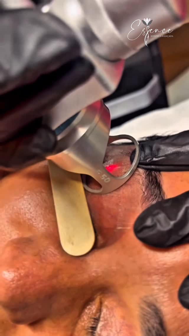 Procedimento estetico divulgado pela Essence