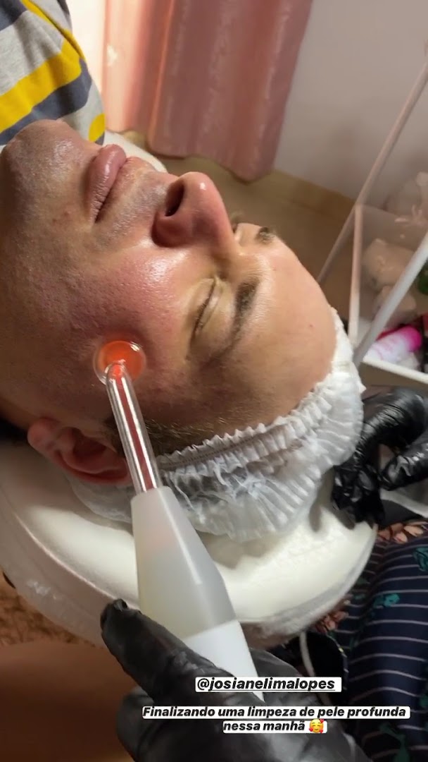 Tratamento facial