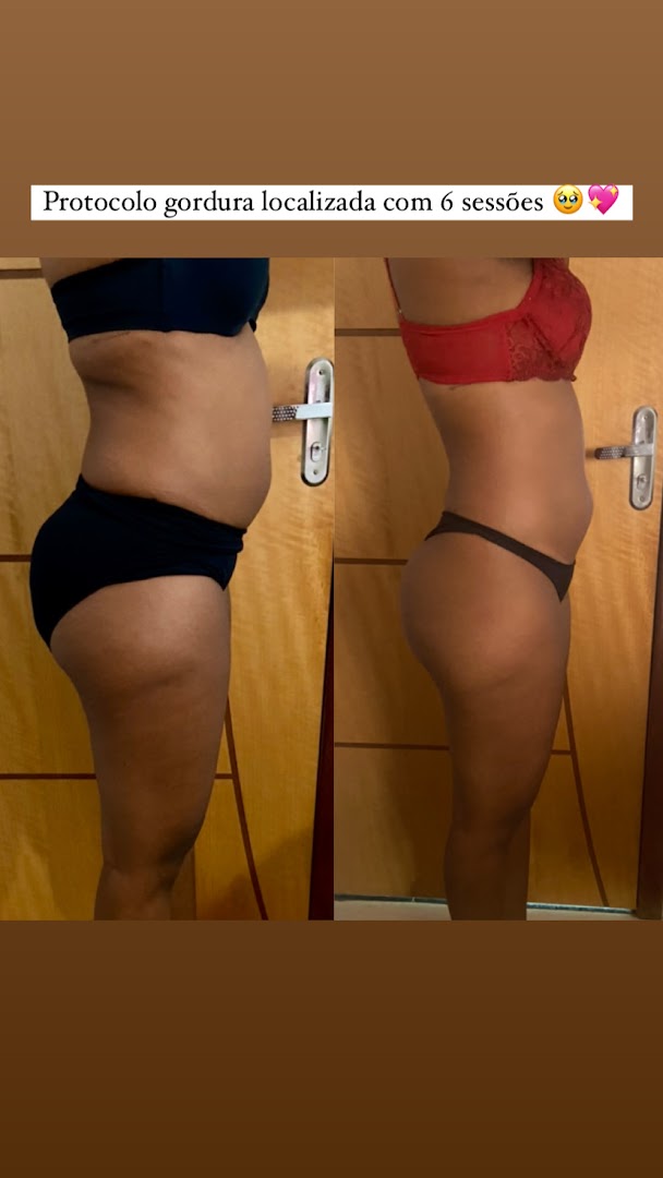 Antes e depois corporal
