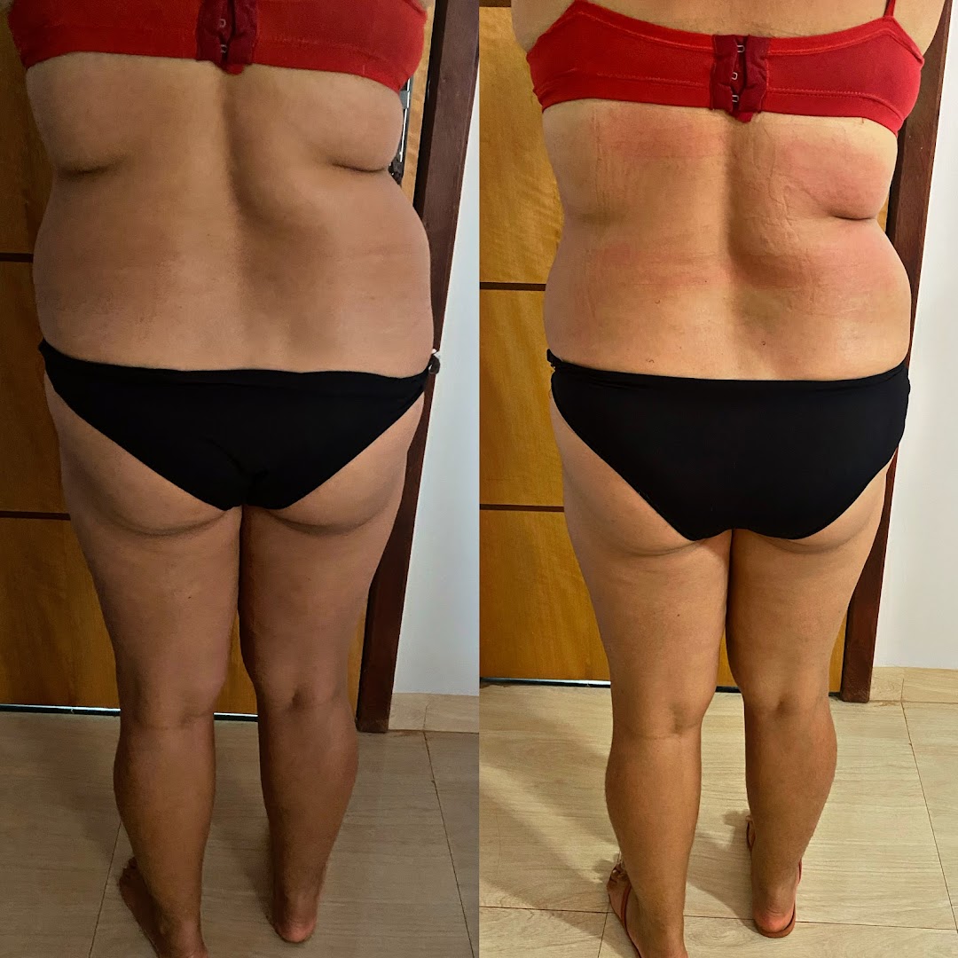 Antes e depois corporal