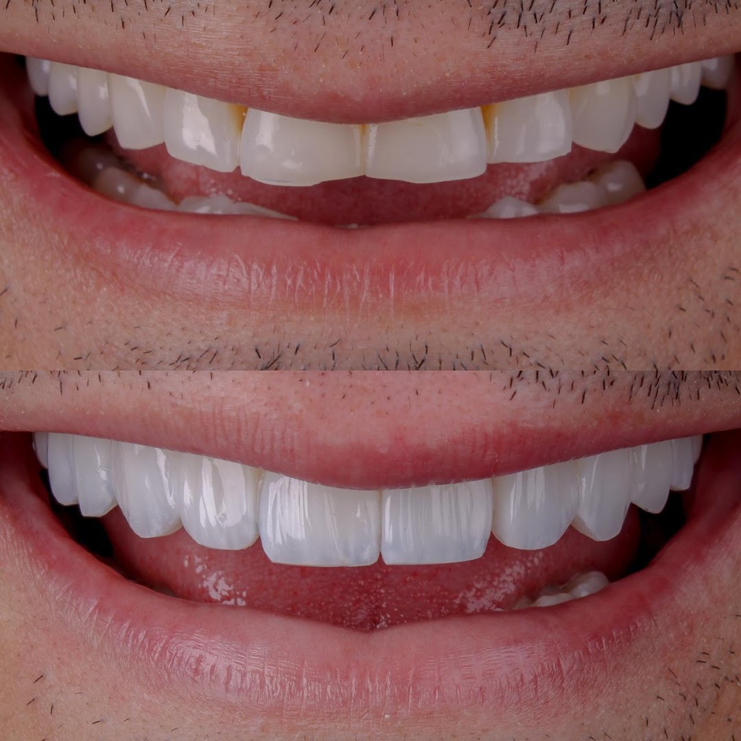 Sorriso alinhado e claro em close